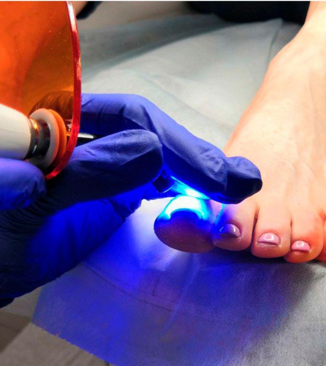 Pedicure Clínico en Querétaro - Adriana Pozas